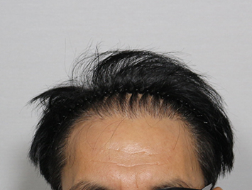 After case 01