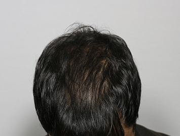 After case 04