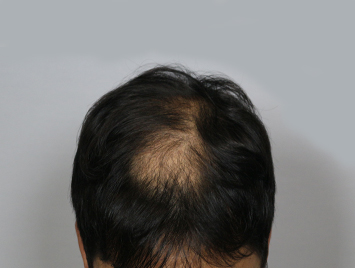 Before case 04