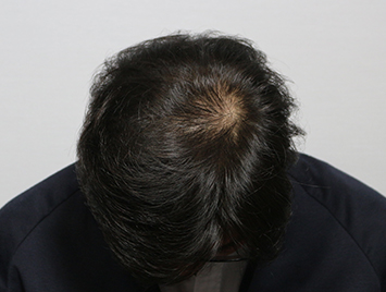 After case 05