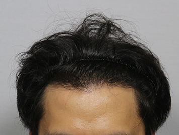 After case 06